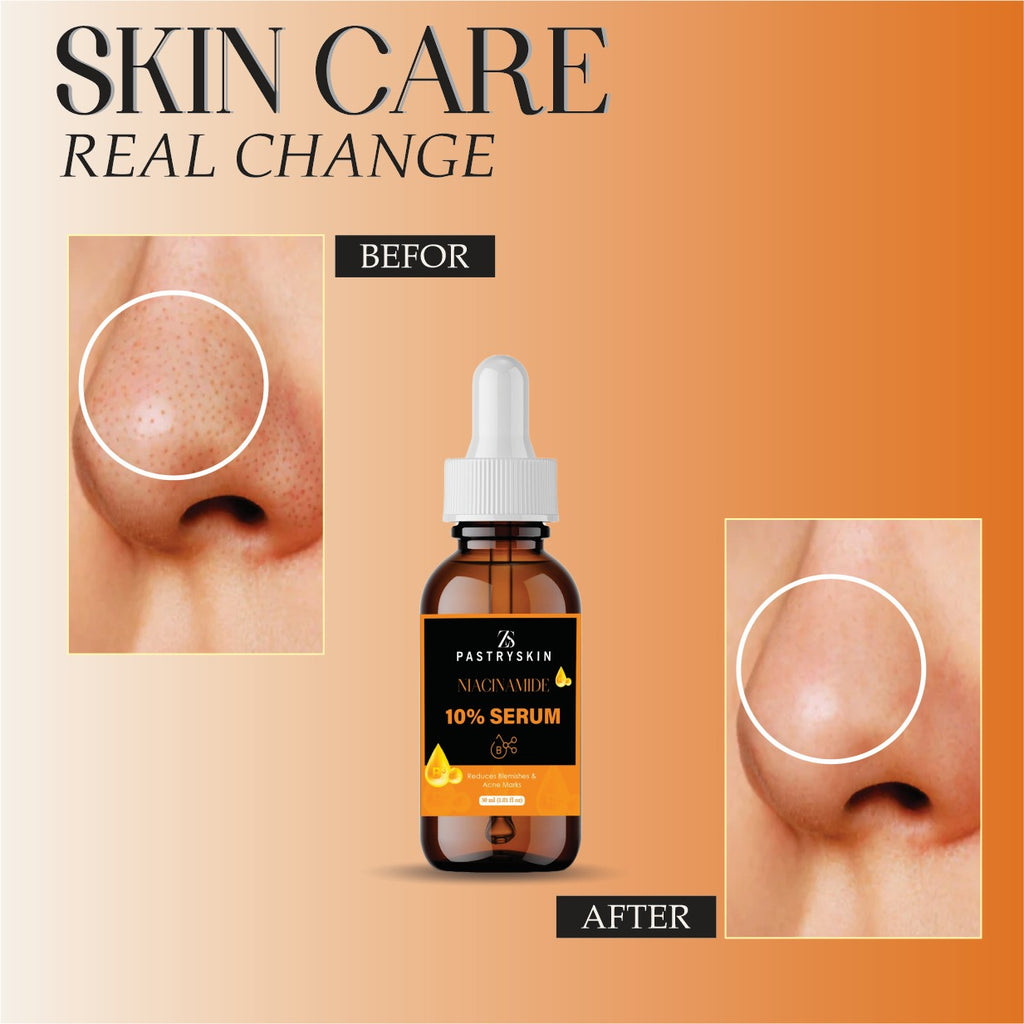 ZS PastrySkin Niacinamide 10% Serum for Men & Women – Brighten Skin, Reduce Dark Spots & Acne Marks, Unisex Skincare