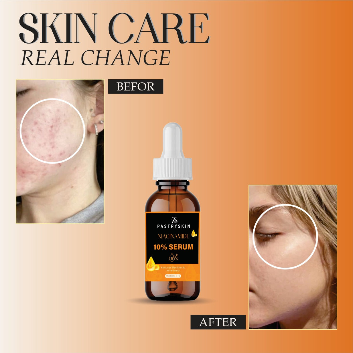 Glow Booster Combo - Skin Brightening & Dark Spot Removal Duo | ZS PastrySkin Niacinamide + Alpha Arbutin Face Serums (2-in-1 Skincare Set)