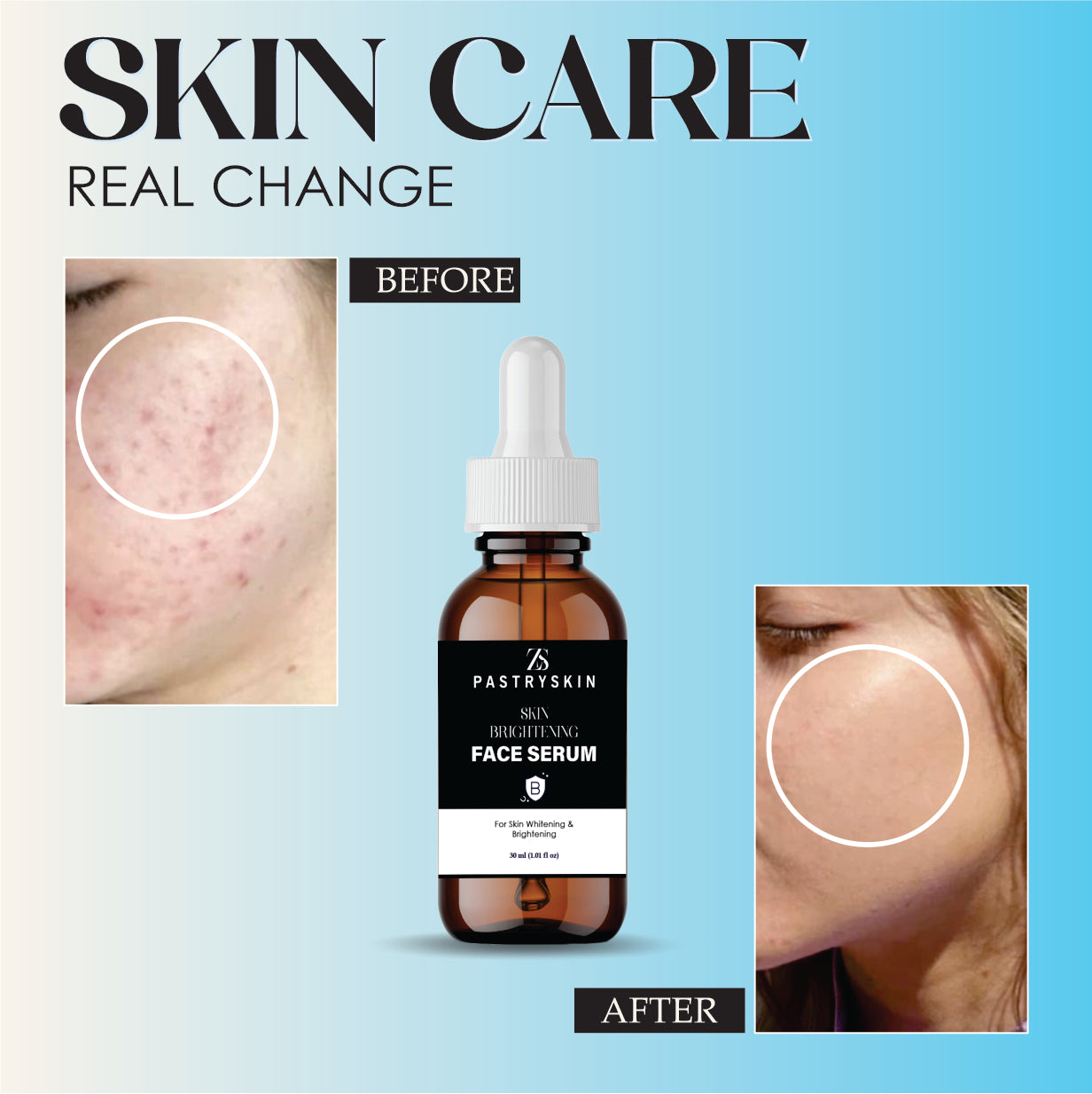 ZS PASTRYSKIN - Skin Brightening Face Serum For Skin Whitening & Brightening (Unisex)