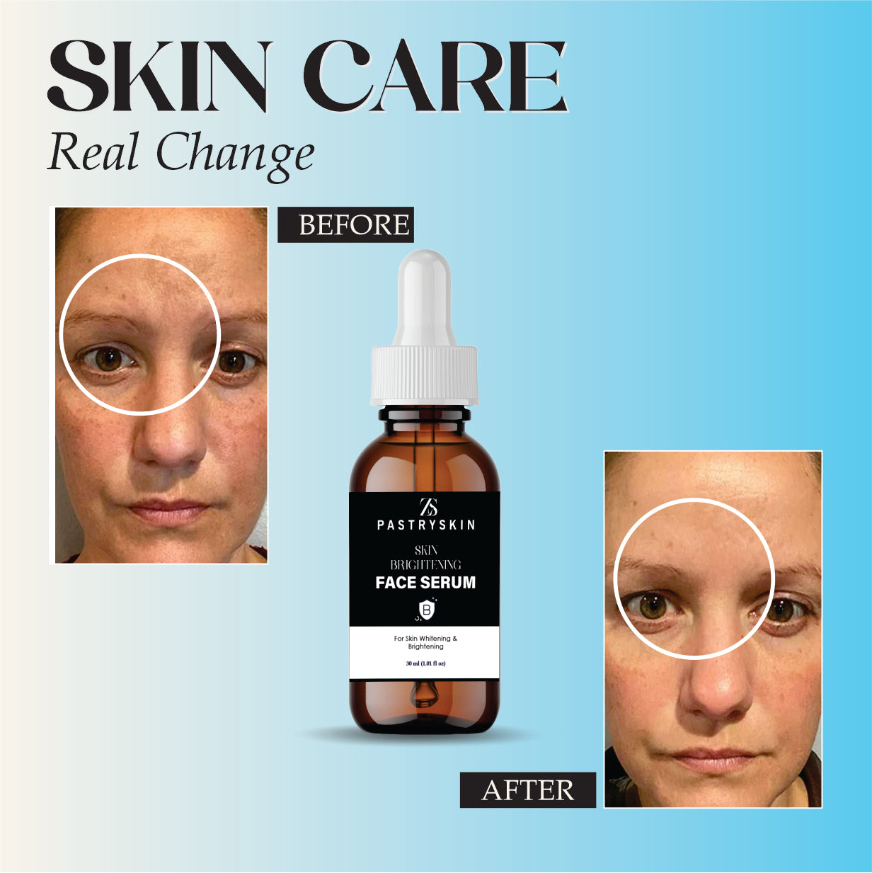 ZS PASTRYSKIN - Skin Brightening Face Serum For Skin Whitening & Brightening (Unisex)