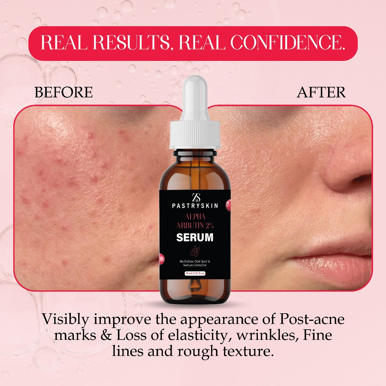 ZS PastrySkin - Alpha Arbutin 2% Serum – Brightening & Advanced Dark Spot Corrector  Even Skin Tone, Unisex Skincare